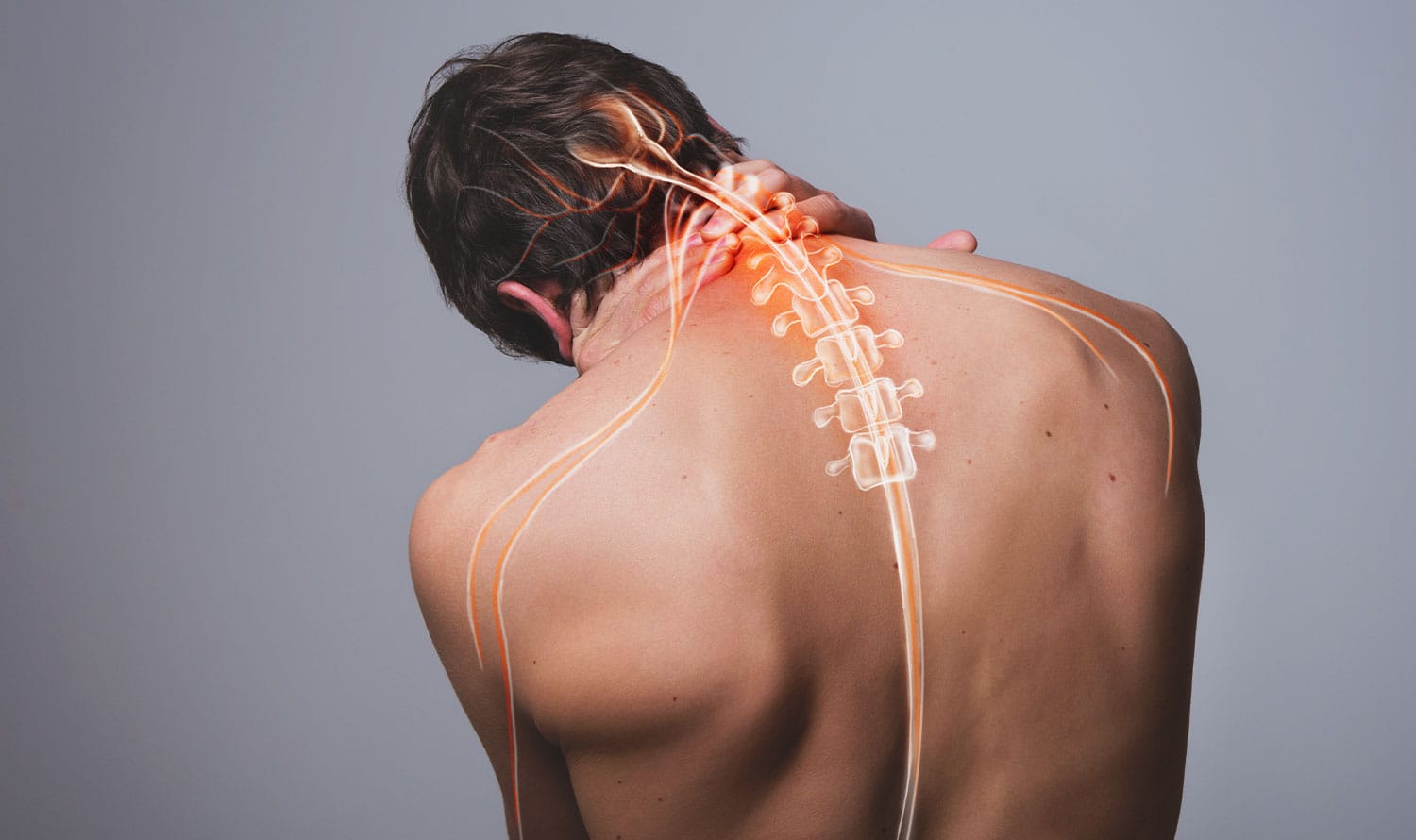Decoding Cervical Radiculopathy: Understanding the Root of Pain, Numbness, and Weakness